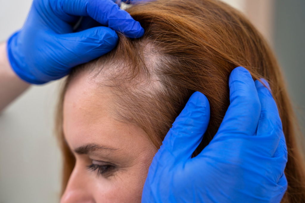 Mulher no médico com perda de cabelo.